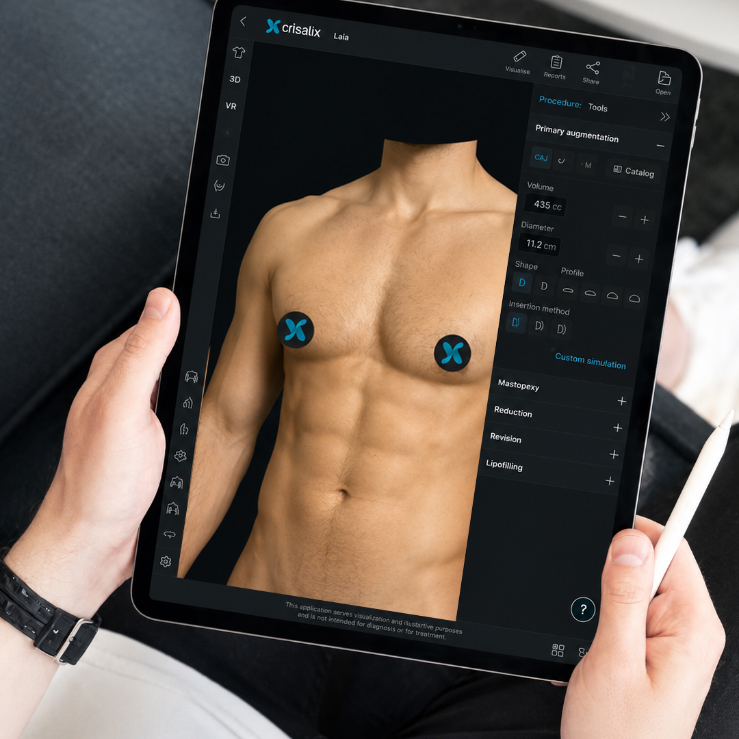 Crisalix: как 4D-моделирование снижает количество повторных консультаций хирурга